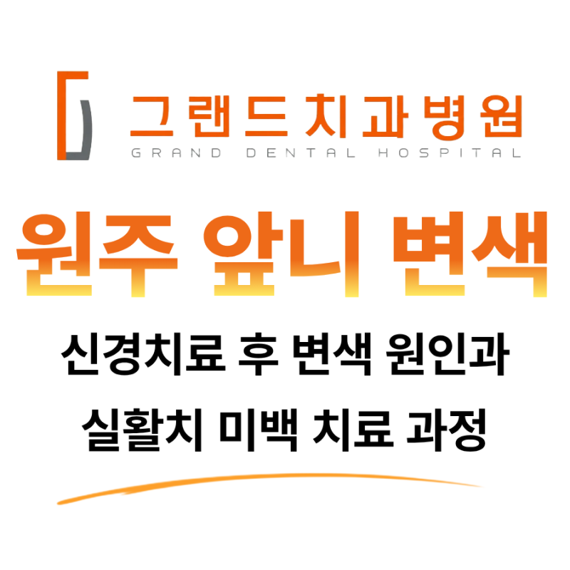 원주 신경치료 후 앞니 변색, 실활치 미백은 어떻게 하나요?