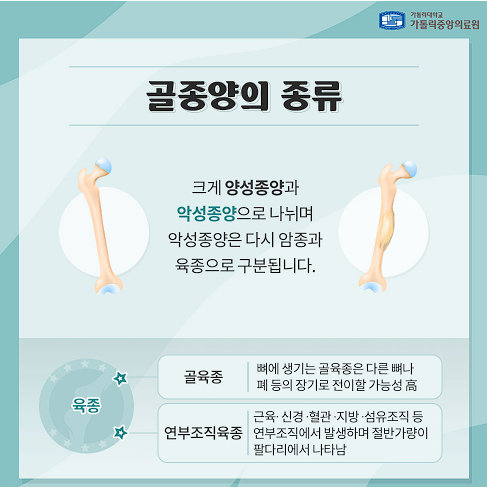 골육종 증상과 치료법, 초기 발견이 중요한 이유 총정리