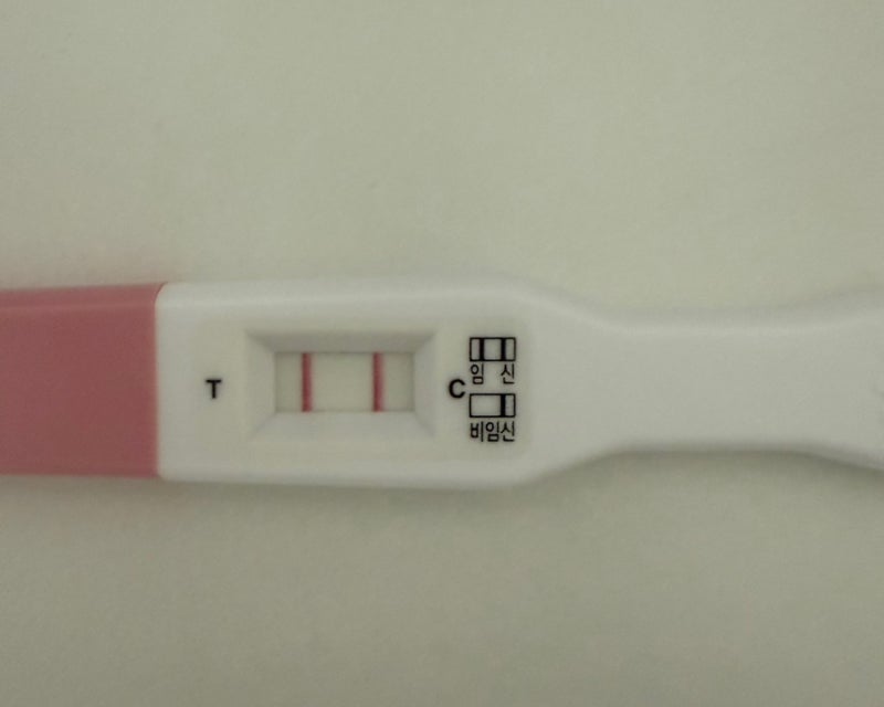 [출산 일기] 임신성고혈압 vs 임신중독증 증상 변화