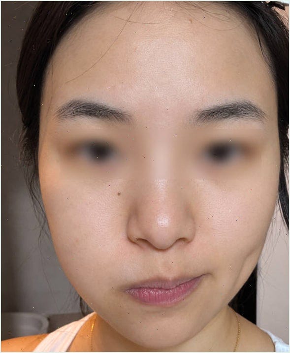 마데카솔겔 두 달 동안 이렇게 써봤어요