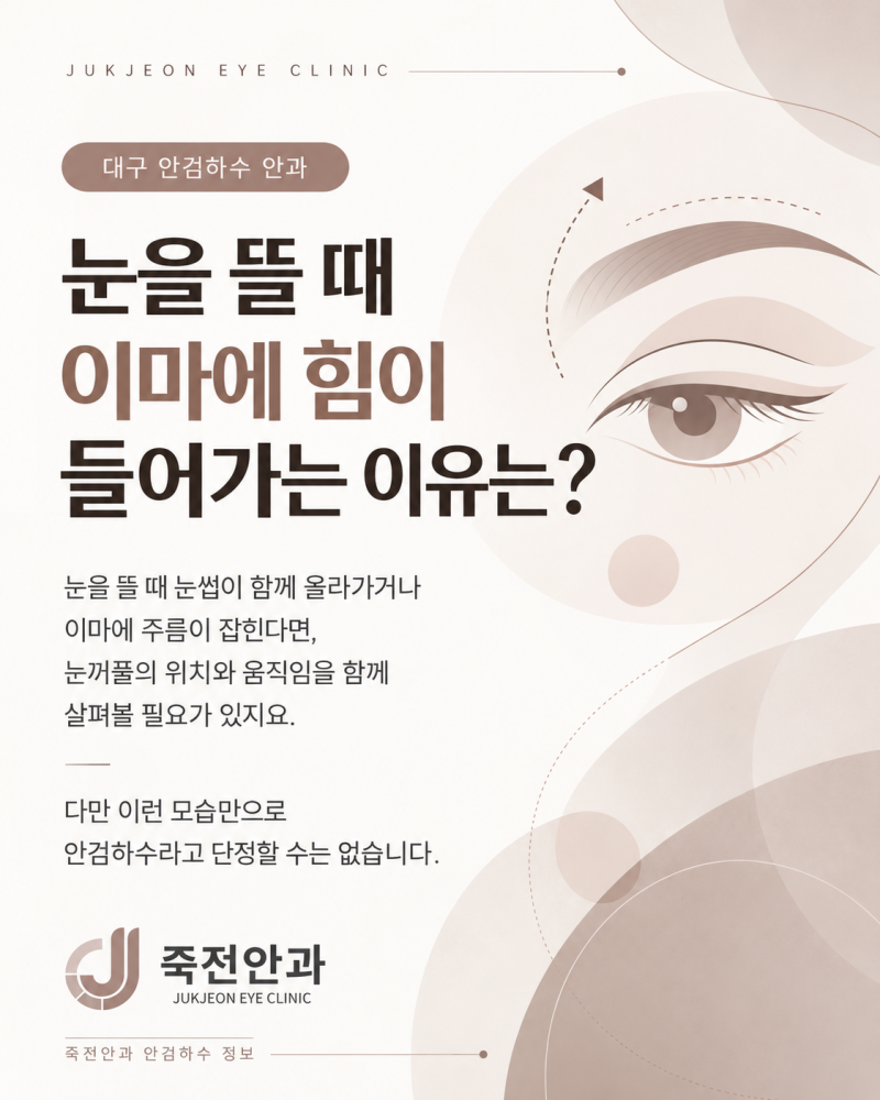 대구 안검하수 안과, 눈을 뜰 때 이마에 힘이 들어가는 이유는?