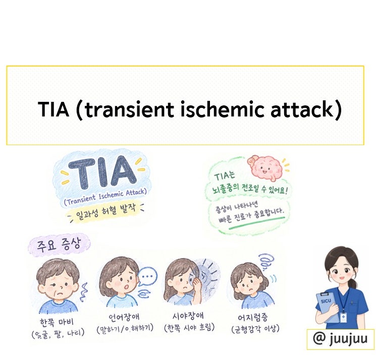 일과성 허혈 발작: TIA (transient ischemic attack), 꼭 알아둬야 할 뇌졸중의 경고 신호 !