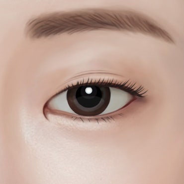 쌍꺼풀 수술 전, 쌍꺼풀 테이프는 언제부터 끊어야 할까요?