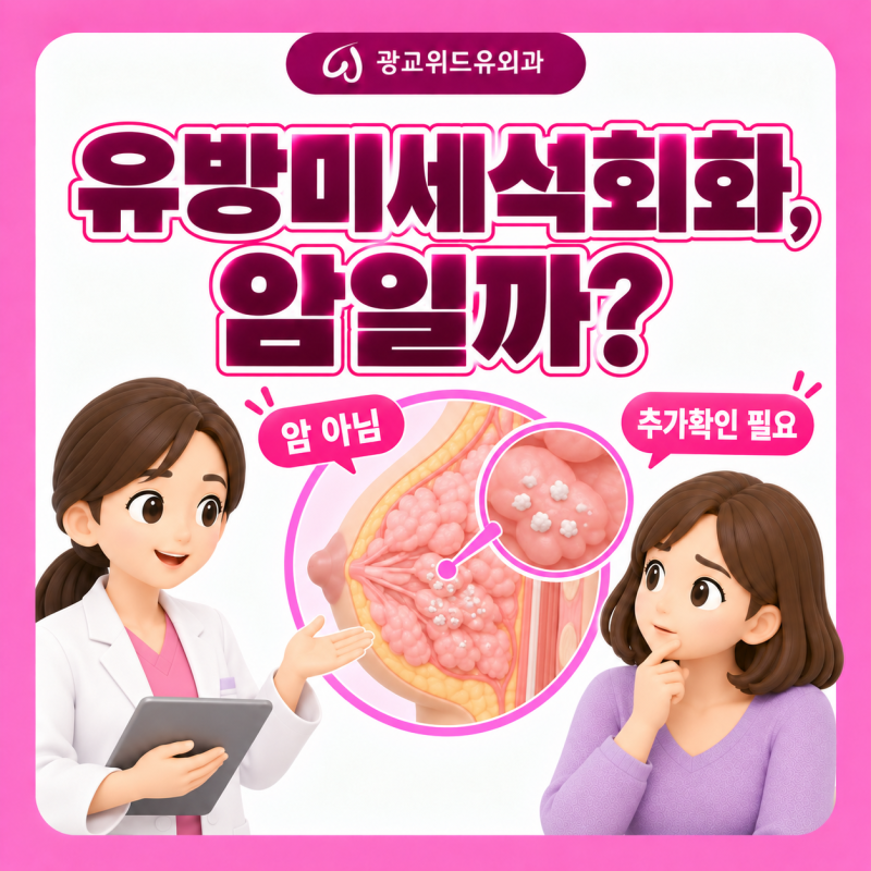 유방 미세석회화, 발견되면 반드시 조직검사를 받아야 할까요?