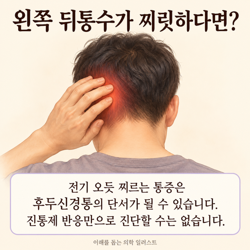 왼쪽 뒤통수 통증 원인 후두신경통 의심 증상 3가지