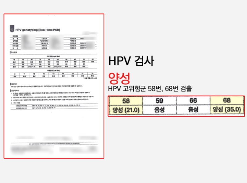 자궁경부이형성증 2단계와 3단계, CIN2-3에서 원추절제술은 필수일까?