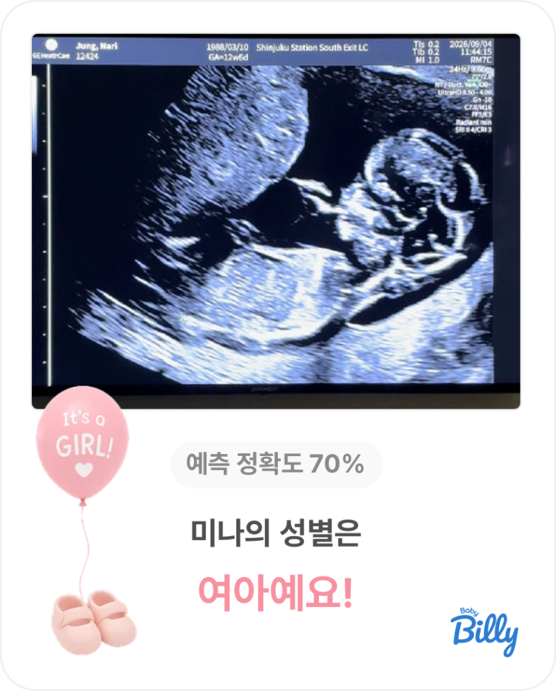 임신 17주 4일 l 성별이 너무 궁금해