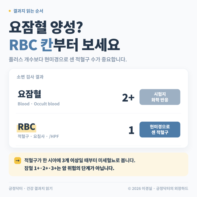 소변검사 요잠혈 양성, 소변 색은 멀쩡한데 왜 그럴까요?