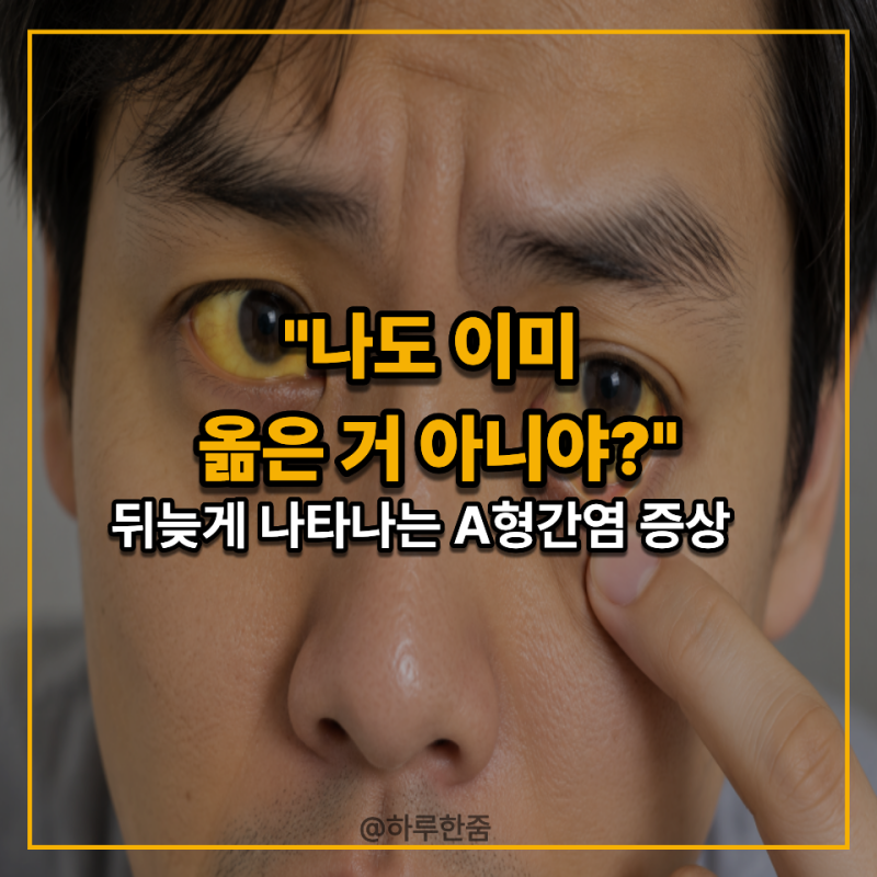 "나 술도 거의 안 마시는데 간염이라고?" 의외로 음식 통해 옮을 수 있다는 A형간염 증상