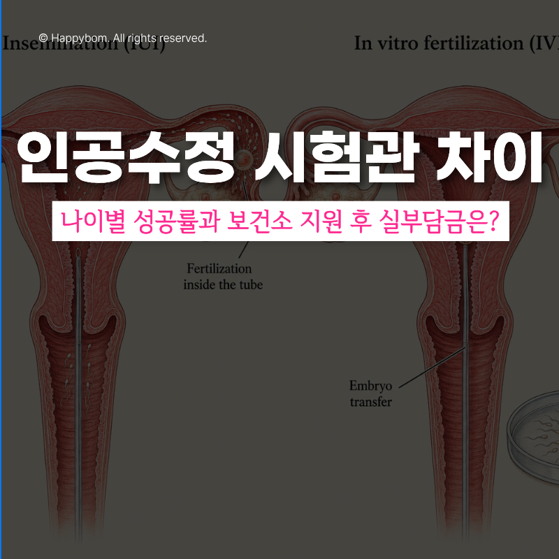 "인공수정부터 해야 할까?" 인공수정 시험관 차이, 성공률·비용·부작용 총정리