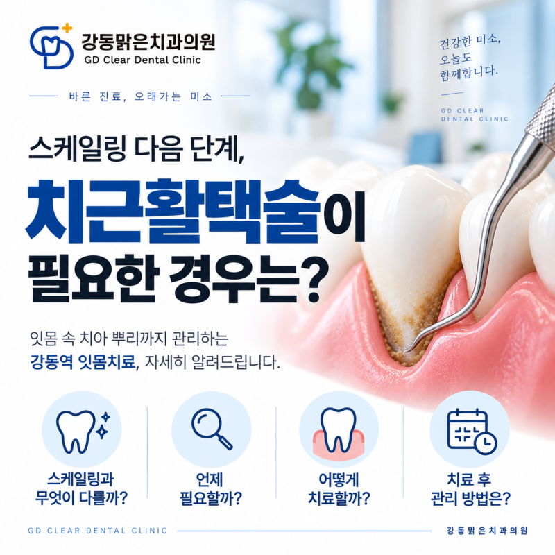 강동역잇몸치료, 스케일링 다음에 ‘치근활택술’이 필요한 경우는?