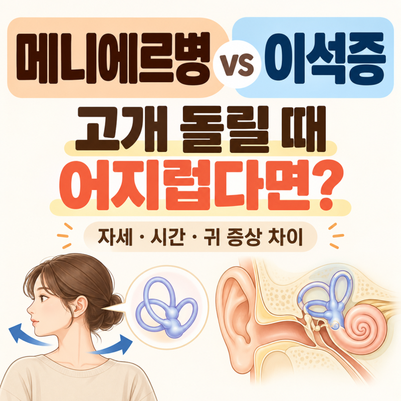 고개 돌릴 때 어지러운 것도 메니에르병일까? 이석증과 차이 확인