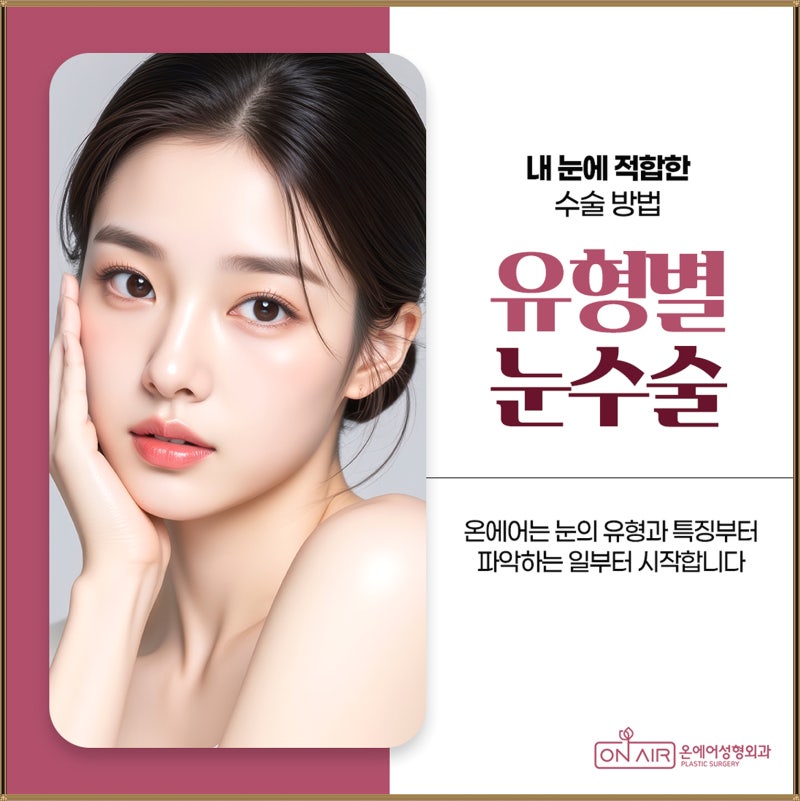 무쌍 눈매교정전후 또렷한 눈매로 달라질 수 있을까요?