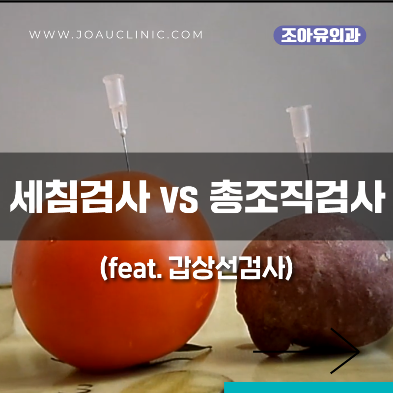 갑상선 세침검사와 총조직검사는 똑같은 검사가 아니다?