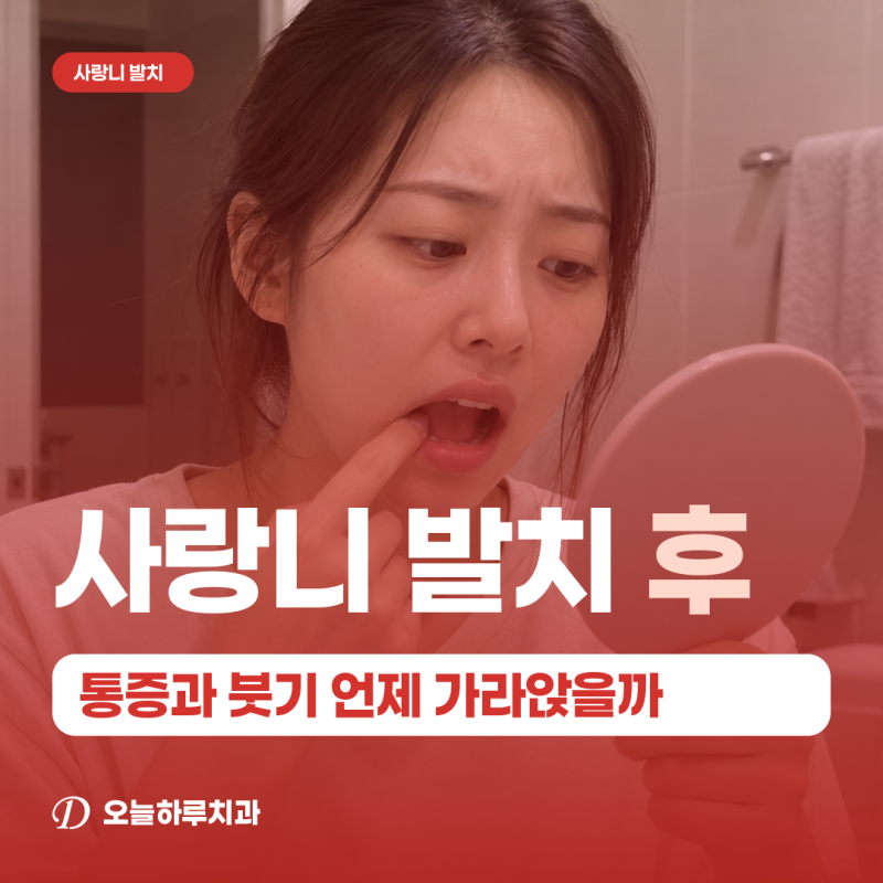 낙성대치과 | 사랑니 발치 후 통증과 붓기 언제 가라앉을까?