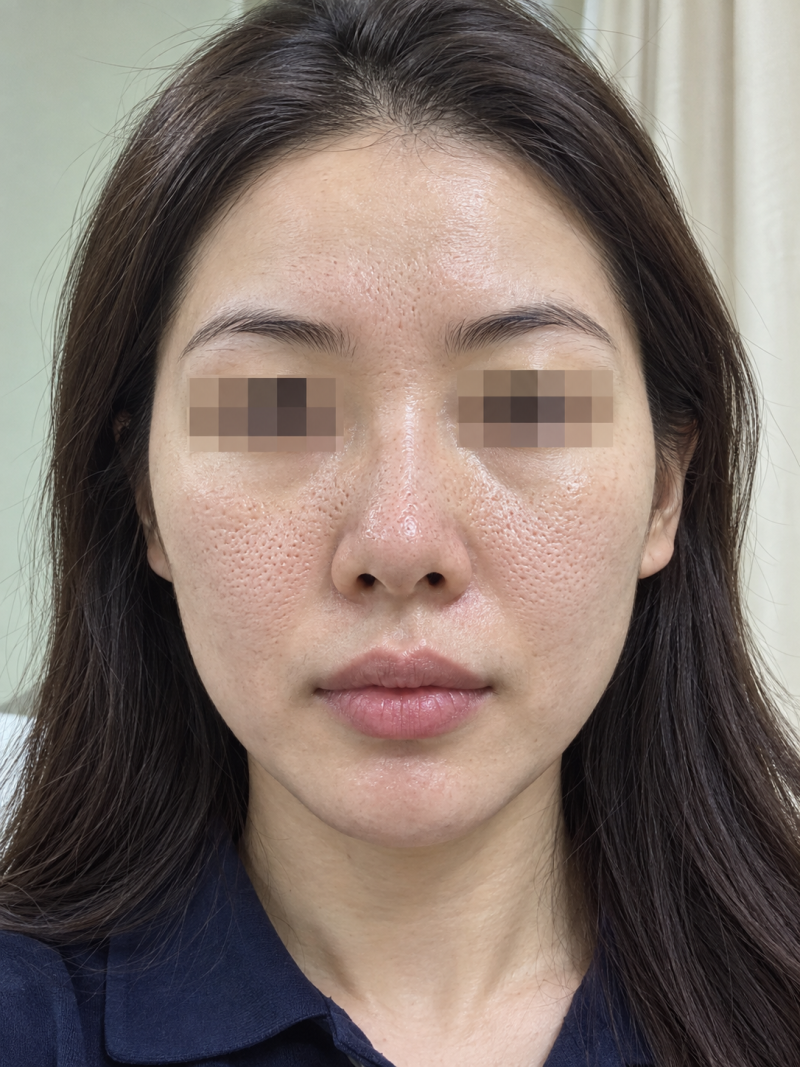 리들샷 부작용 겪지 않는 법 효과적인 케어 루틴 총정리