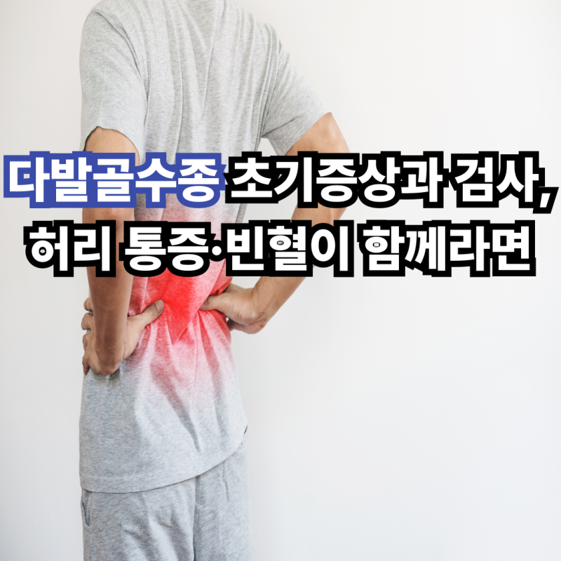 다발골수종 초기증상과 검사, 허리 통증·빈혈이 함께라면