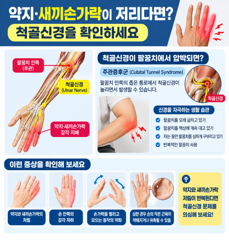 손이 찌릿찌릿 저려요? 손가락별로 알아보는 손 저림 원인과 해결법