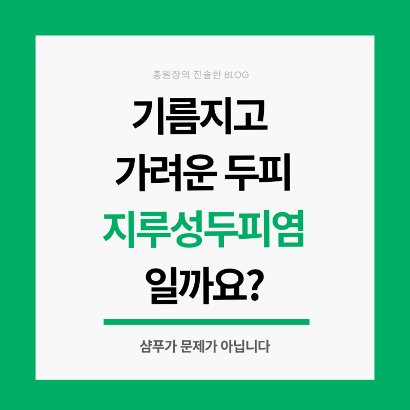 지루성 두피염, 왜 자꾸 반복될까요?