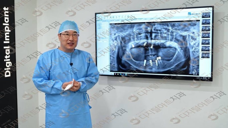 부산임플란트잘하는곳에서 상악동 거상술 필요성을 살피는 검사