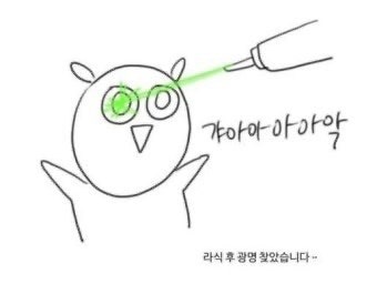 [강남역] ㅂㅇㅅㅁ안과: 실크라식 후기 (가격 / 할인 / 통증)
