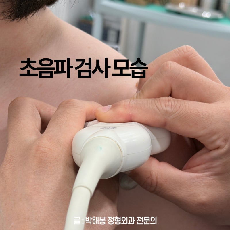 어깨, 손목 석회성건염 수술 없이 제거하는 치료방법