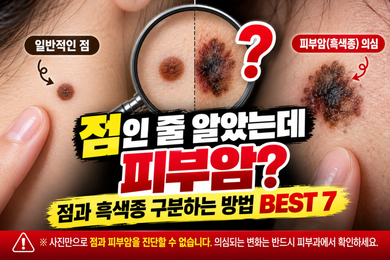 점인 줄 알았는데 피부암?
