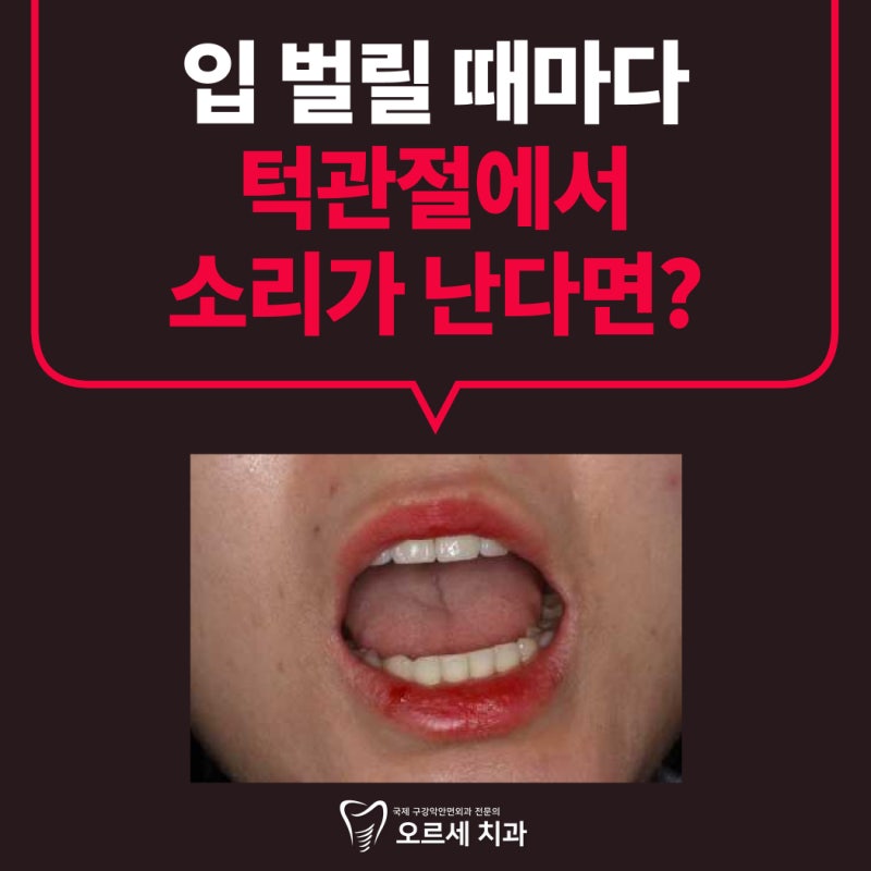 턱관절 딱딱 소리와 사각사각 소리는 왜 다를까요