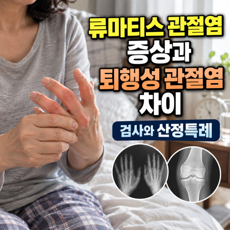 류마티스 관절염 증상과 퇴행성 관절염 차이, 검사와 산정특례