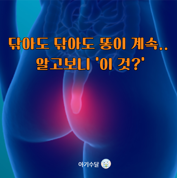 항문이 계속 가렵다면? 닦아도 계속 나오는 이것... 항문소양증의 원인과 자극 줄이는 생활관....