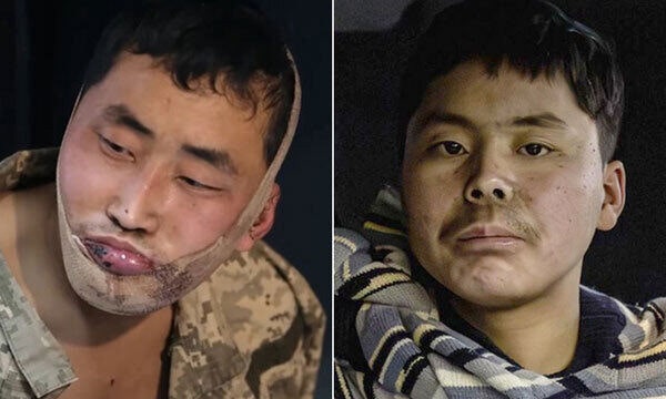 북한군 포로 송환, 본질은 인간의 존엄이다