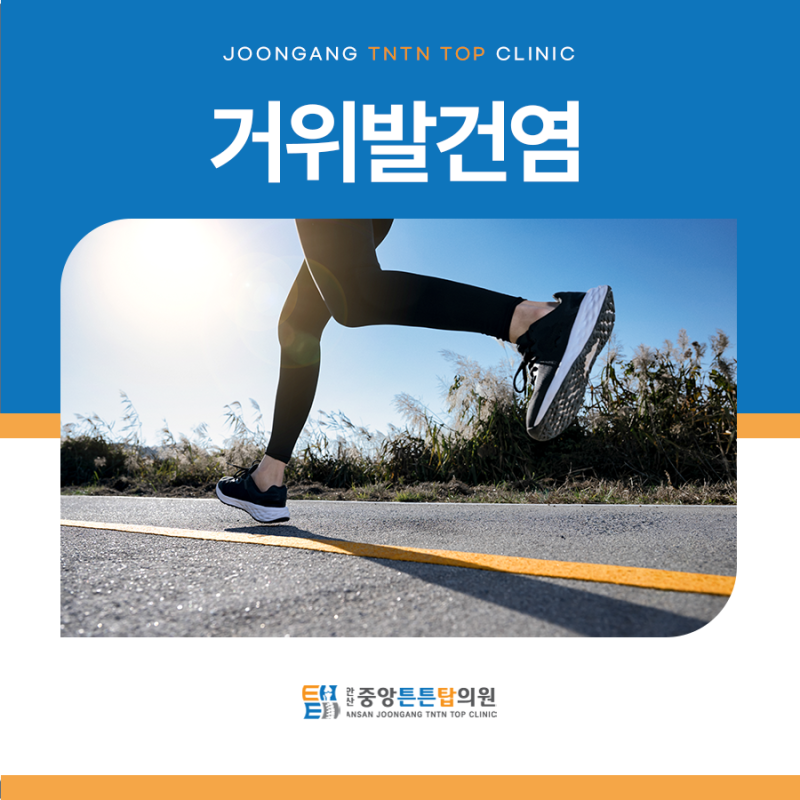 거위발건염 증상, 무릎 아래 안쪽 통증이 반복된다면