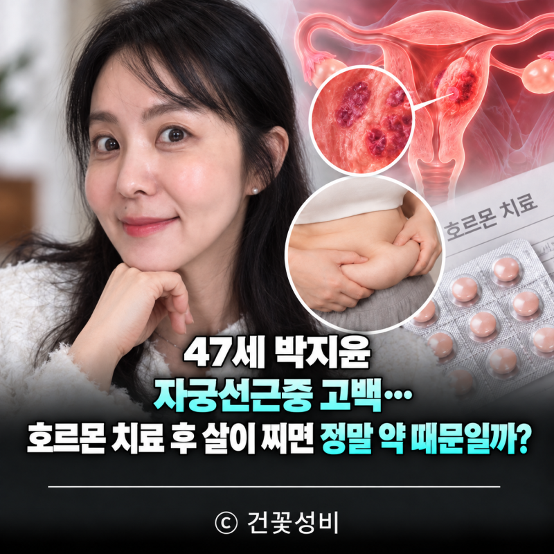 47세 박지윤 자궁선근증 고백…호르몬 치료 후 살이 찌면 정말 약 때문일까?