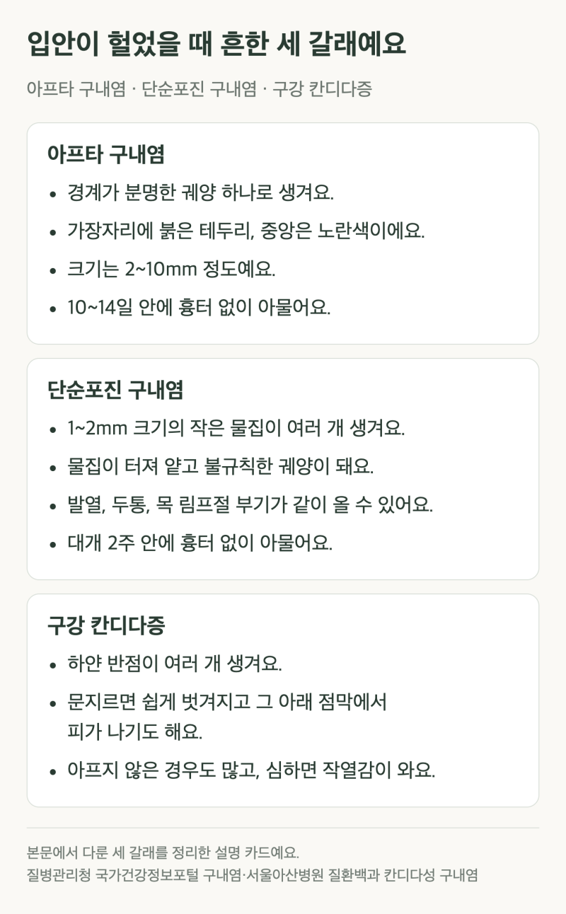 구내염 종류, 입안이 헐었을 때 아프타와 헤르페스 구별하는 법
