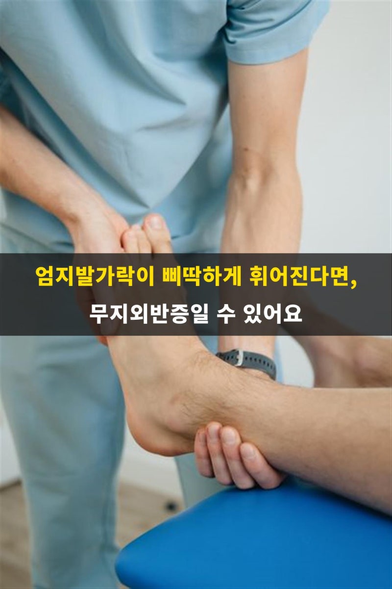 엄지발가락이 삐딱하게 휘어진다면, 무지외반증일 수 있어요