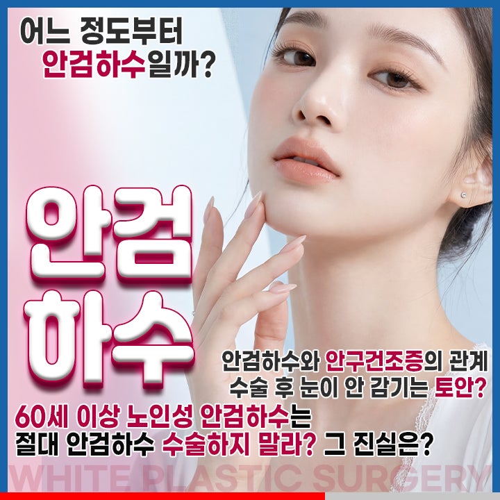 안검하수 노화 기준 아닌 이 기준/ 노인성안검하수는 주의할 점