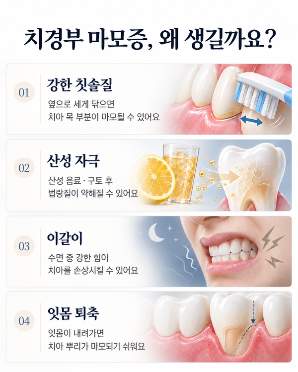 치경부마모증 증상 | 이가 시리고 패인 느낌이 든다면 확인하세요