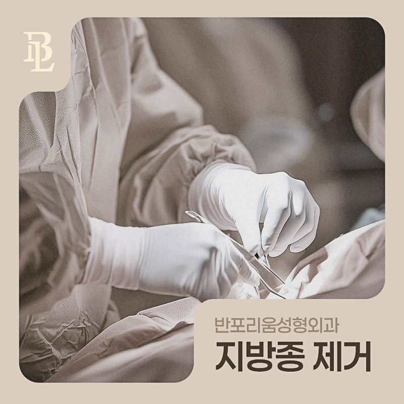 표피낭종수술비 제거하려면 실제로 얼마 정도 생각해야 할까요?