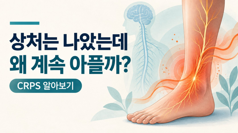 CRPS, 신경계에 이상이 생긴 복합부위통증증후군