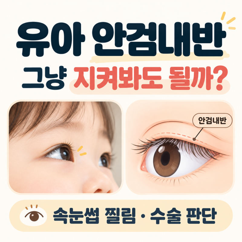유아 안검내반 그냥 지켜봐도 될까? 속눈썹 찔림과 수술이 필요한 경우