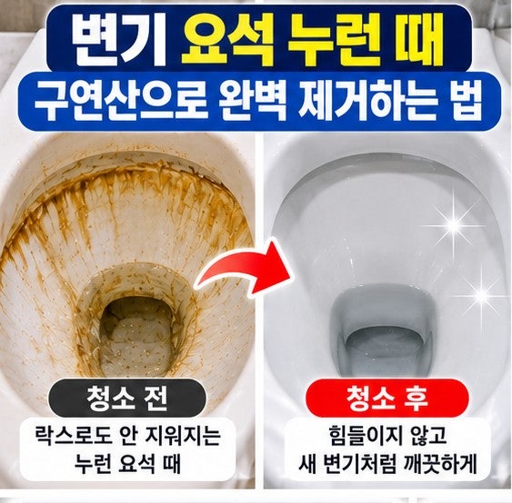 변기 요석 누런 때 제거 방법 및 구연산 식초 청소 꿀팁 (락스로 안 지워질 때)