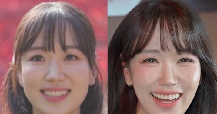 나솔30기옥순 묘하게 예뻐진 시술 공개! 고우리 스킨부스터