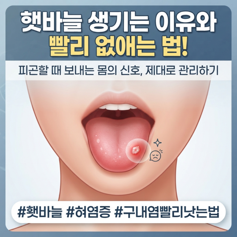 피곤할 때마다 생기는 혓바늘 원인 5가지와 낫는 법 (구강 염증 관리)