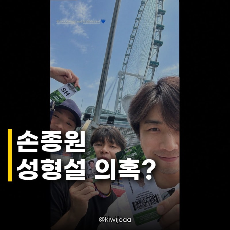 손종원, 붓기 없는 셀카 공개 성형설 해프닝 완벽 종결!