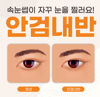 아기 눈이 자꾸 충혈되고 눈물 난다면, 안검내반 증상부터 수술 시기까지 총정리