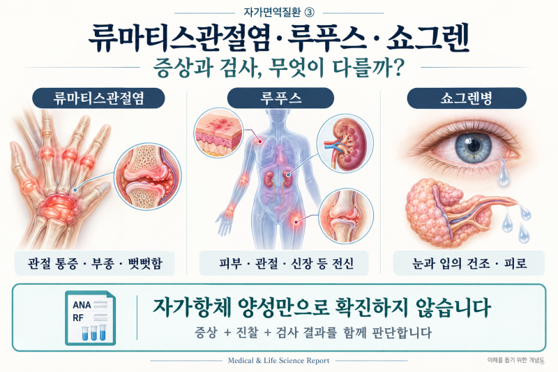 자가면역질환 ③ 류마티스관절염·루푸스·쇼그렌, 무엇이 다를까?