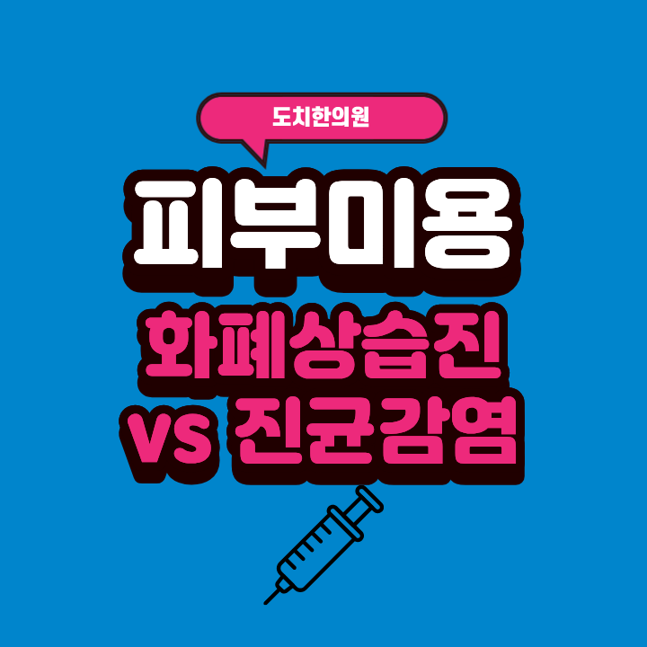 습진인 줄 알았던 종아리 원형 수포 발진::체부백선::진균감염::화폐상 습진::신정동피부치료....