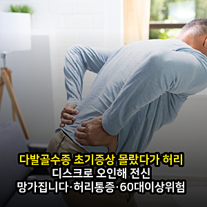 다발골수종 초기증상 몰랐다가 허리 디스크로 오인해 전신 망가집니다·허리통증·60대이상....