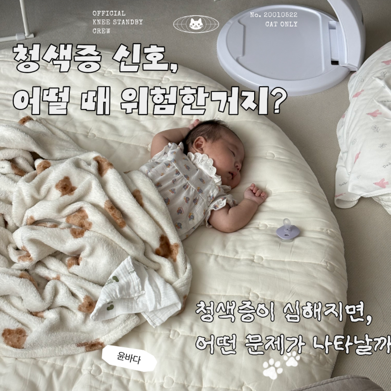 신생아 손발이 파래요, 청색증일까?정상 범위부터 위험 신호, 원인·진단·치료까지 총정리