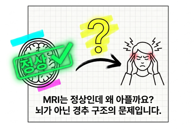 만성 두통과 어지럼증을 부르는 경추성 두통 | 후두하근 도침치료 [서울 도침치료 시리즈 018]